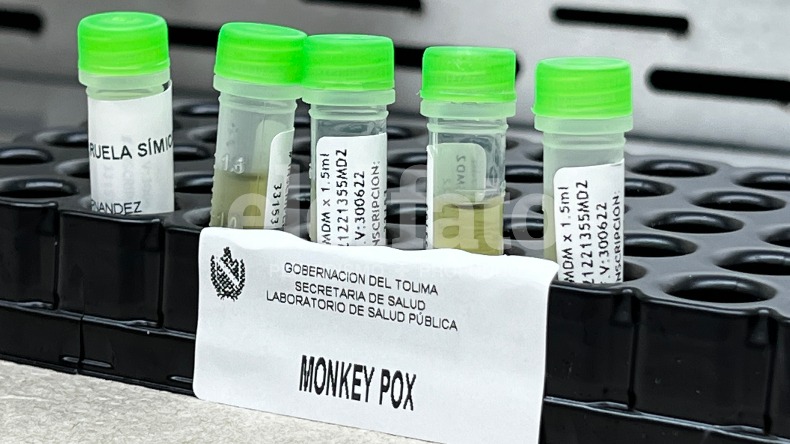 Se registraron dos nuevos casos de viruela del mono en Ibagué
