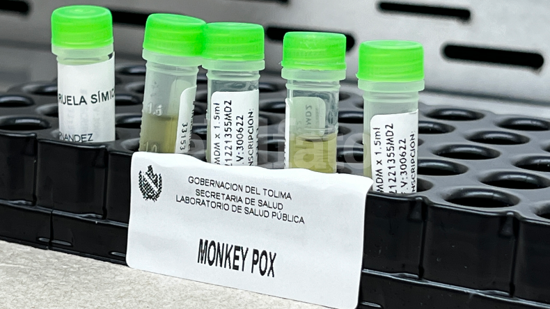 ¿Por qué es importante conocer sobre la viruela símica o del mono?