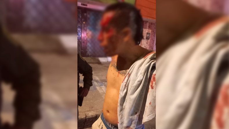 Motociclista en aparente estado de embriaguez atropelló a un adulto mayor en el barrio Arado de Ibagué
