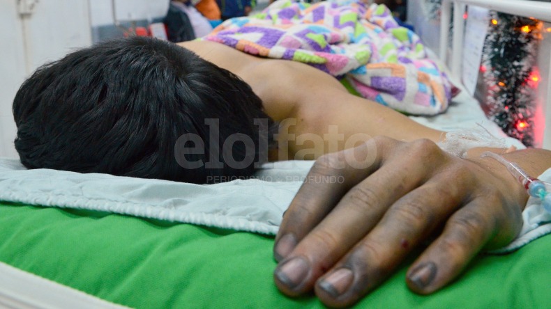 Reportan cinco nuevos casos de quemados por pólvora en el Tolima 