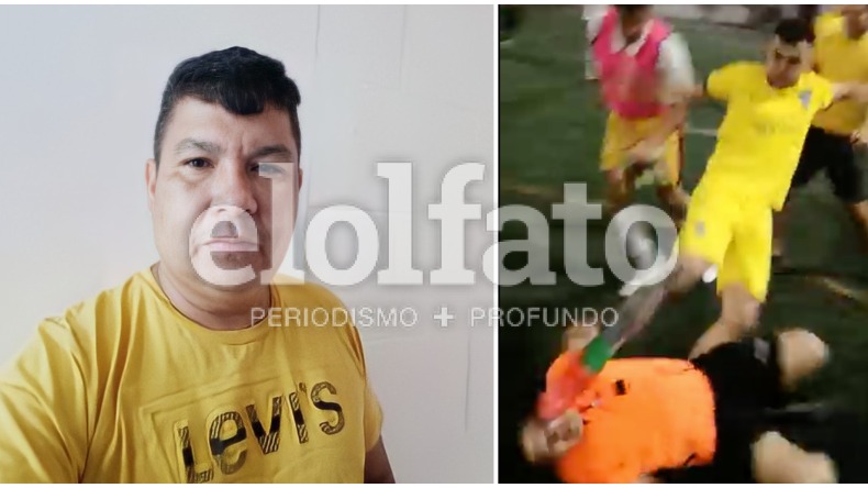 Árbitro golpeado por jugadores enardecidos en Ibagué hace un llamado a la tolerancia
