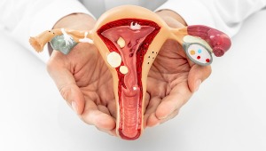 Estos son los 5 tipos de cáncer ginecológico que más afectan a las mujeres en Colombia 