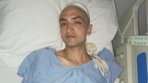 Joven sufrió fractura de cráneo por fuerte golpiza que al parecer recibió dentro de bar en Ibagué 