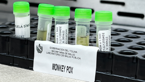 ¿Por qué es importante conocer sobre la viruela símica o del mono?