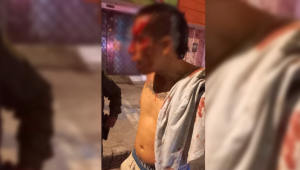 Motociclista en aparente estado de embriaguez atropelló a un adulto mayor en el barrio Arado de Ibagué
