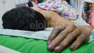 Menor de 14 años resultó quemado por pólvora en Ibagué